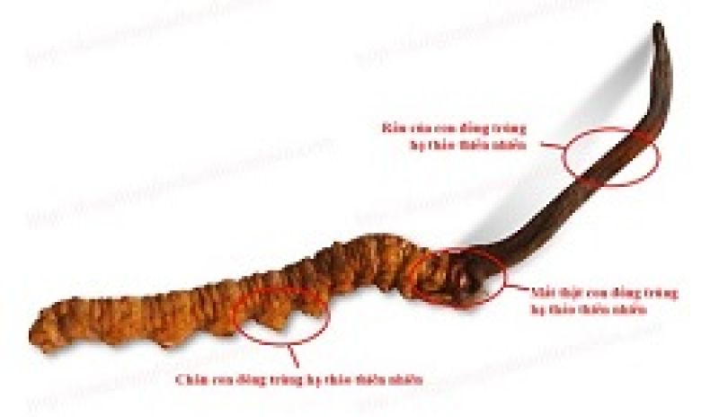 67 ngày cứu chữa bé trai bị nhánh cây rơi trúng đầu