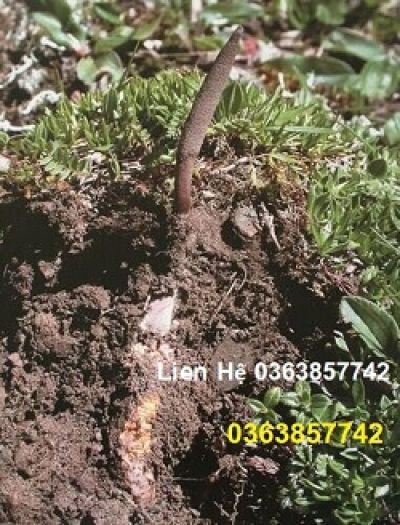 B&eacute; trai 11 tuổi nuốt hạt đậu v&agrave;ng 10 gram để 'r&egrave;n lưỡi'