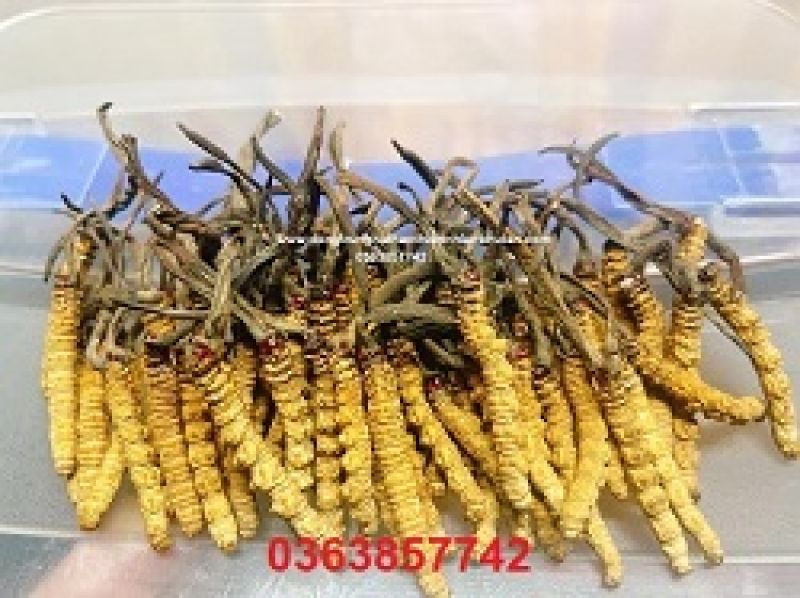 Bộ Y tế siết quy tr&igrave;nh gh&eacute;p tạng sau vụ mua b&aacute;n l&aacute; gan 1,5 tỷ đồng