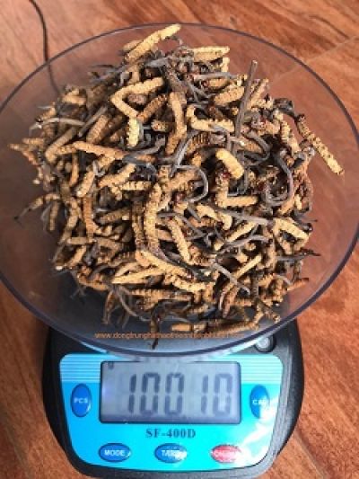 Ca hiến thận 'c&oacute; một kh&ocirc;ng hai' của cụ &ocirc;ng 80 tuổi cho con trai