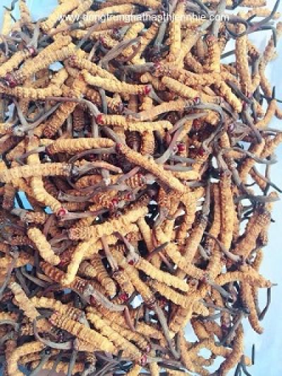 Tăng canxi m&aacute;u k&eacute;o d&agrave;i do u tuyến cận gi&aacute;p